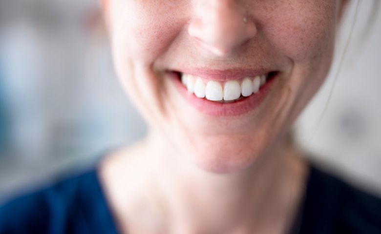 Smile gallery